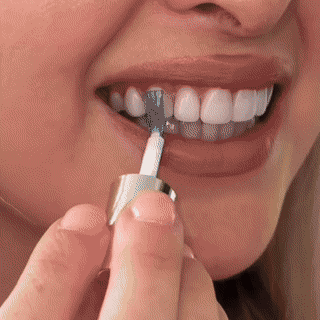 Aplicarea polishului cosmetic temporar PureWhite pe suprafața dinților